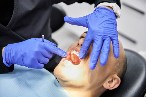 Best Emergency Dental Care for Broken or Chipped Teeth in Elverson, PA